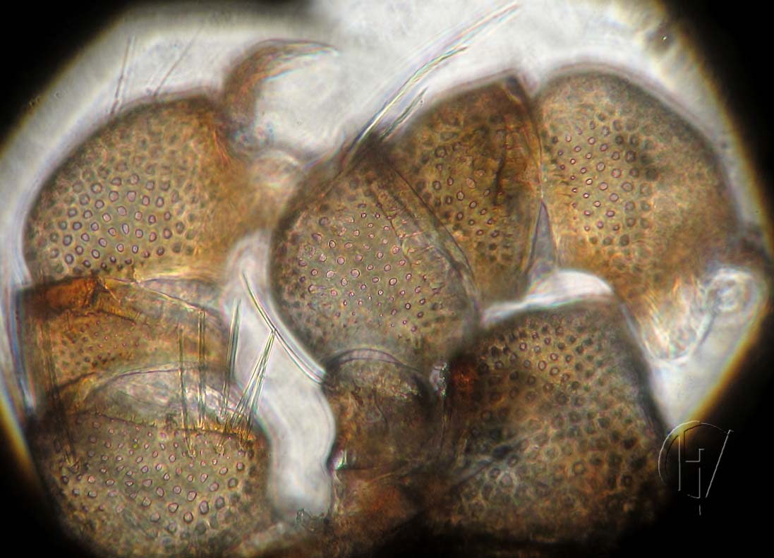 Arrenurus cf. buccinator, palps of female specimen 16-07-2012