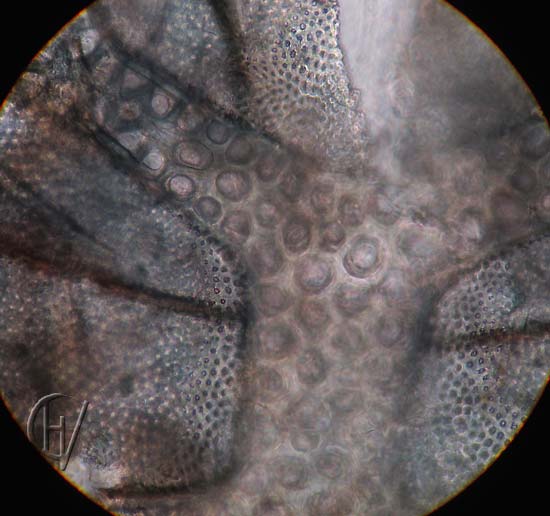 Arrenurus buccinator, vrouwtje, detail epimeren 16-07-2012