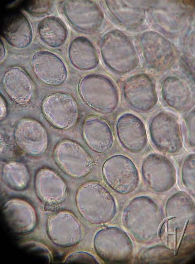 Arrenurus buccinator, vrouwtje, detail pantsering 16-07-2012