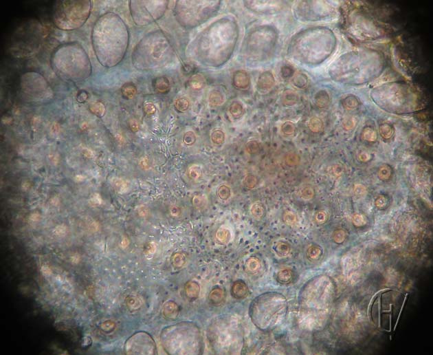 Arrenurus buccinator, vrouwtje, detail pantsering 16-07-2012