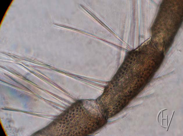Arrenurus buccinator, vrouwtje, detail pantsering 16-07-2012