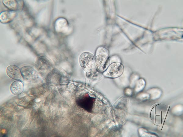 Sessile peritirchs on Cyclops 10 apr 2024