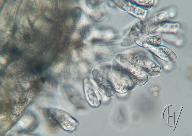 Sessile peritrichs on Cyclops 10 apr 2024