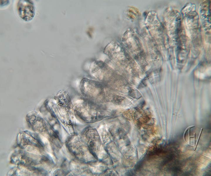 Sessile peritrichs on Cyclops 10 apr 2024