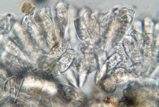 Sessile peritrichs on Cyclops 10 apr 2024