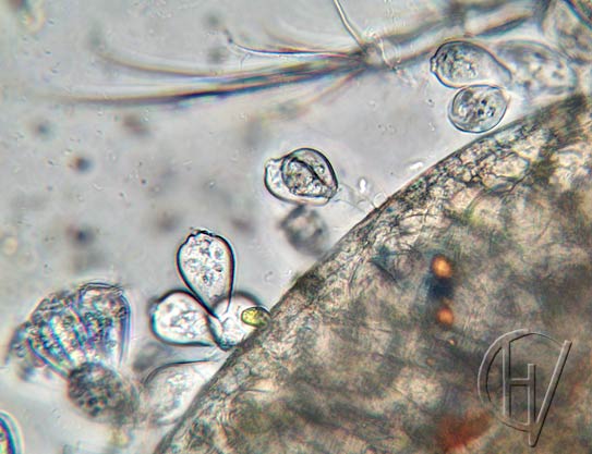 sessile peritrichs on Cyclops 10 apr 2024