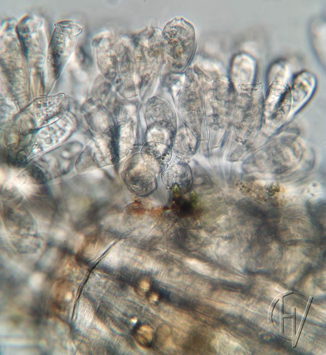 sessile peritrichs on Cyclops 10 apr 2024